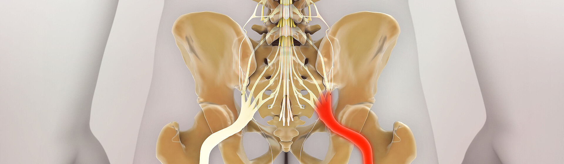 Sciatica_sciatica_pain_lower_back_nerve