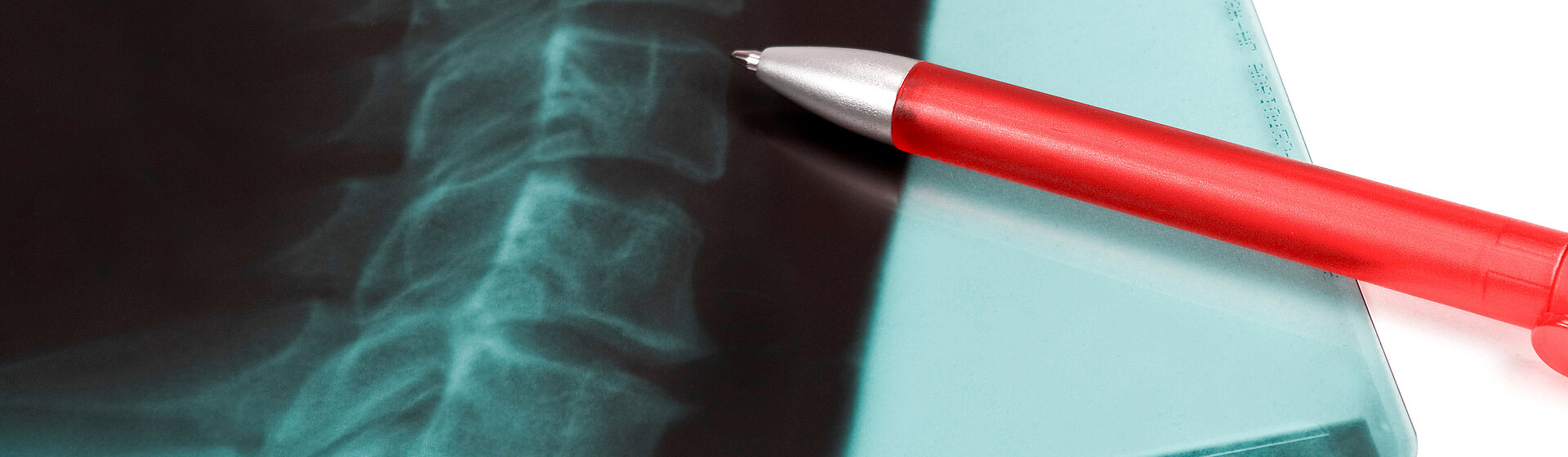 vertebral_fracture_spine_osteoporosis_specialist_specialist_clinic