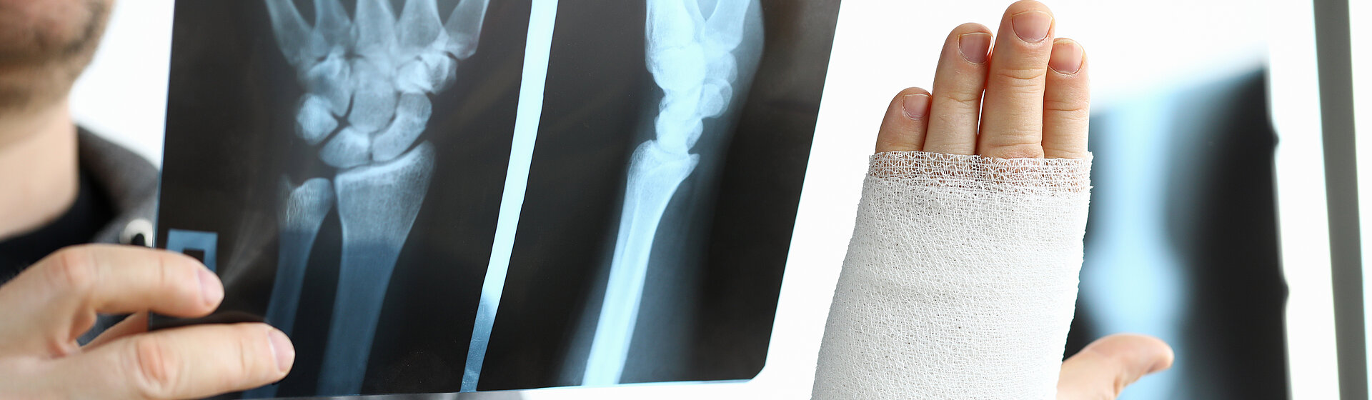 fracture_fracture_accident_surgery_x-ray_sports_injury_osteoporosis_